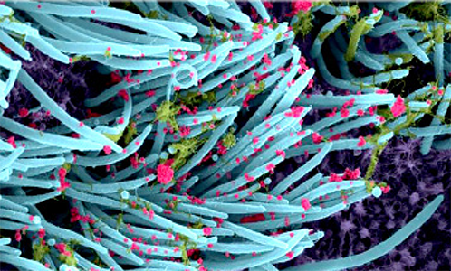 التقليل من شدَّة المرض “سارس/ سراس” “Sars- cov- 2″ ” Sras- cov- 2″